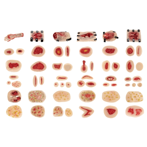 58部件创伤评估模块