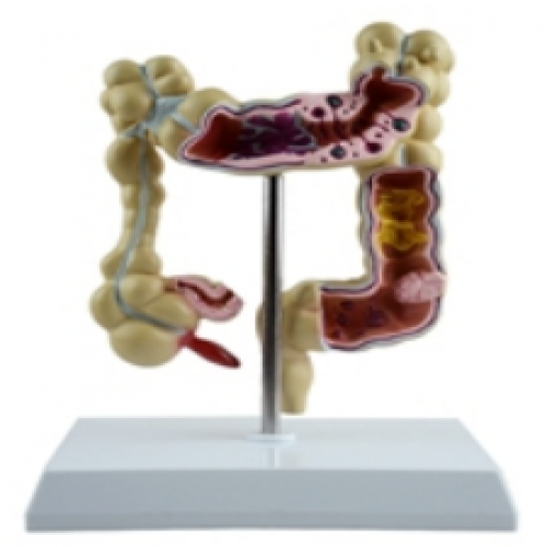 病理大肠模型