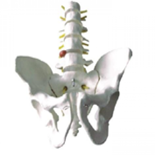 骨盆带五节腰椎模型