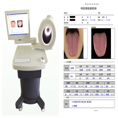 中医舌诊图像分析系统（台车式）