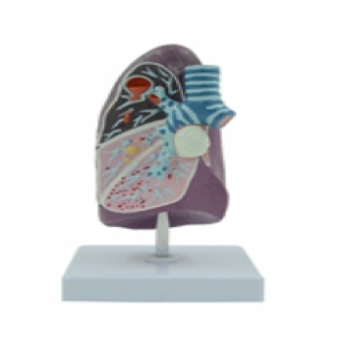 病理肺模型